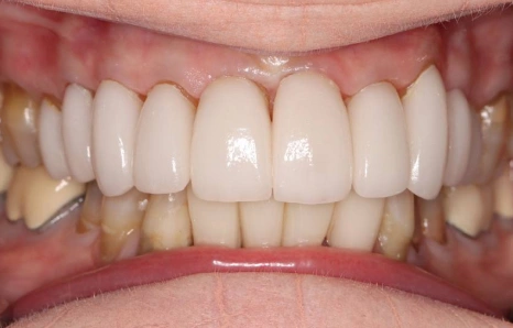 Img-before-and-after - AFTER 2